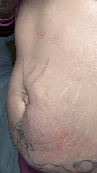 Gold Sculpt Firming Gel applied on the stomach