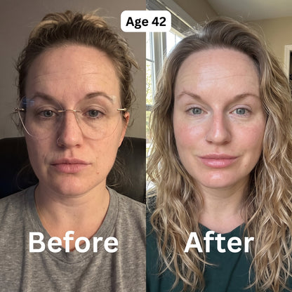Before and after at age 42